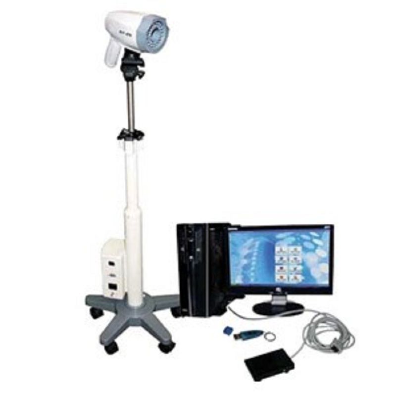 MM-5,digitalni kolposkop,1 cena Beograd